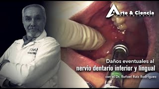 ►Daños eventuales al Nervio Dentario Inferior y lingual  Dr Rafael Ruíz Rodríguez [upl. by Egidio]