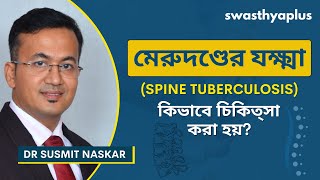 মেরুদণ্ডের যক্ষ্মা চিকিৎসা কি  What is Spine Tuberculosis in Bangla  Dr Susmit Naskar [upl. by Otanutrof]