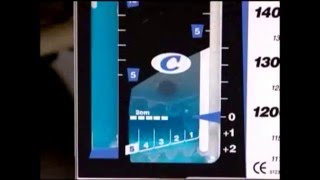 CHEST TUBE amp DRAINAGE SYSTEM [upl. by Myron]