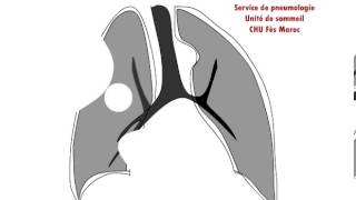 signe des interfaces pr elbiaze service de pneumologie chu fès morocco [upl. by Dionysus]