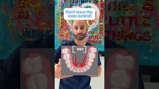 Invisalign to straighten your roots [upl. by Sucramal]