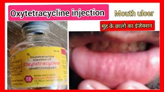 Oxytoxin injection l mouth ulcer l मुंह के छालो का इंजेक्शन l Oxytetracycline injection use in hindi [upl. by Nareik]