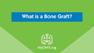 What is a Bone Graft [upl. by Gertrude]