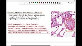 Intro to pathology tissue repair 1 [upl. by Gilles]