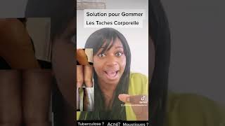 Solution pour Gommer les Taches noires au niveau du corps [upl. by Arres]