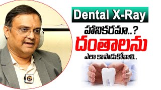 Advantage Of Dental XRay  Dental Treatment  Teeth Protection  Helthtips  Dhatri Health [upl. by Mile]