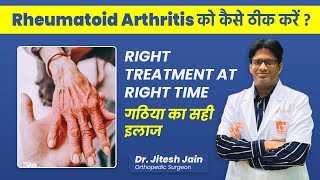 Rheumatoid Arthritis Treatment in Hindi  Osteoarthritis vs Rheumatoid Arthritis  Dr Jitesh Jain [upl. by Aihsenal598]