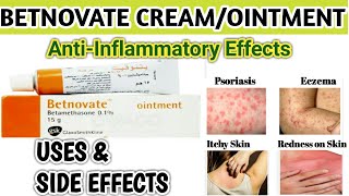 Betnovate Cream  Betnovate Ointment Uses and Side Effects in Hindi and Urdu [upl. by Rexer]