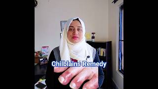 Chilblains Remedy l Toe swelling in winter l chilblains viral footcare [upl. by Enneles]