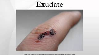 Exudate [upl. by Aurlie]