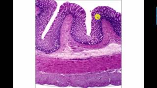 Ileum and Large Intestine Data Show [upl. by Innoj]