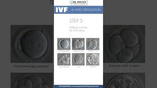 IVF Explained StepbyStep Process of In Vitro Fertilization [upl. by Siri]