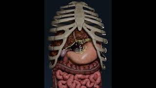 Ascites in liver cirrhosis 😱 [upl. by Hekking]