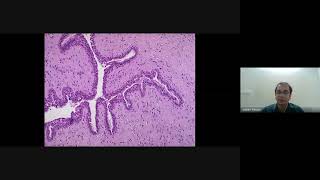 Breast Pathology basics [upl. by Leveridge]