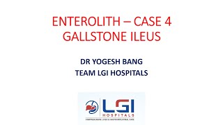 ENTEROLITH CASE 4  GALLSTONE ILEUS [upl. by Auod]