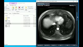 LargeScale MultiCenter CT and MRI Segmentation of Pancreas with Deep Learning [upl. by Kcirdot]