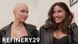 Chloe Bean’s Alopecia Journey  Wig Transformation  Hair Me Out  Refinery29 [upl. by Guise]