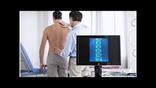 ¿Qué es un angioma vertebral causas síntomas y tratamiento  Mejor con Salud [upl. by Verla154]