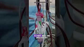 How Hemodialysis Filters Blood  Quick Overviewhemodialysis kidneydialysis dialysistreatment [upl. by Razal]