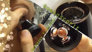 HU Klinische Optometrie  Procedure Gonioscopie Goldmann 3mirror [upl. by Cassey]