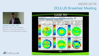 James C Loden MD Clinical Use of the Holladay Report on the Pentacam® for Surgery [upl. by Neibaf]