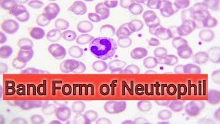 Band form in wbc count [upl. by Iteerp937]