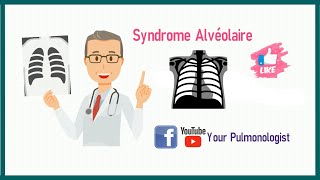 Série Radio  Syndrome alvéolaire de A à Z [upl. by Bentlee219]