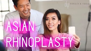 Model Undergoes Revision Asian Rhinoplasty with Rhinoplasty Specialist  Dr Donald B Yoo MD [upl. by Cnahc936]