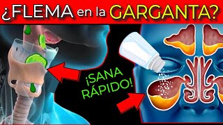 Cómo SE CURA LA FLEMA De La GARGANTA MUCOSIDAD CONSTANTE [upl. by Brade]