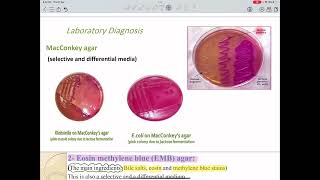 Enterobacteriaceaemicrobiology lab [upl. by Kata]