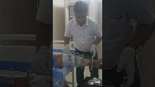 Deformity correction by ilizarov technique post surgical physiotherapy and rehabilitation [upl. by Okoy]