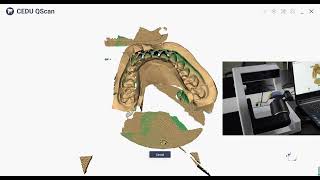 QSCANPRO Dental Scanner One Side Impression Scan [upl. by Solohcin]