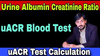 Urine Albumin Creatinine Ratio Test  uACR Test  uACR Test Procedure  uACR Test Calculation [upl. by Tessie505]