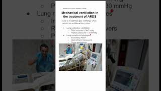 Mechanical ventilation in the treatment of ARDS [upl. by Tullusus]