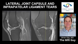 26 year old with knee injury from football [upl. by Tom]