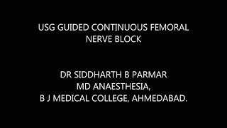 USG guided continuous femoral nerve block [upl. by Pammi]