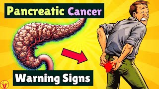 10 Warning Signs of PANCREATIC CANCER That Will SHOCK You  VisitJoy [upl. by Atisor]