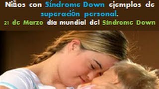 Niños con SINDROME DOWN que son ejemplo de superación personal [upl. by Dunton]