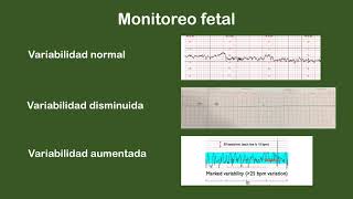 Monitoreo fetal  MEDIAVILLA  Obstetricia  Fundación H A Barceló [upl. by Knitter]