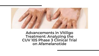 New HOPE for vitiligo  Phase 3 Clinical Trial of Afamelanotide amp Phototherapy  vitiligotreatment [upl. by Julissa375]