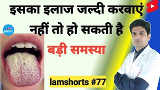 इसका इलाज जल्दी करवाएं नहीं तो हो सकती है बड़ी समस्या Shorts lamshorts [upl. by Lissie]