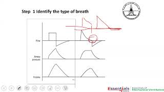 Mechanical ventilation part 4 [upl. by Rudman]