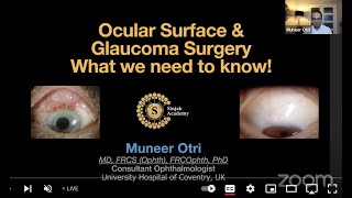 Glaucoma  Taming The Monster  Ocular Surface and Glaucoma Surgery  Muneer Otri [upl. by Gamin363]