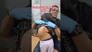 Scoliosis treatment by RKM drrajneeshkant [upl. by Nnaeiram]