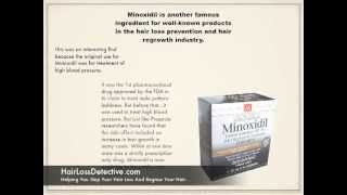 Minoxidil All You Need To Know In Growing Back Your Hair With Minoxidil Treatment [upl. by Schoof]