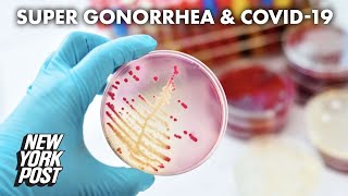 Overuse of antibiotics for COVID19 to blame in super gonorrhea spike  New York Post [upl. by Ivana]