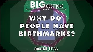 Why do people have birthmarks  Big Questions  Ep 217 [upl. by Braca]