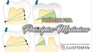 Prótese Fixa 2 Princípios Mecânicos [upl. by Hiller]