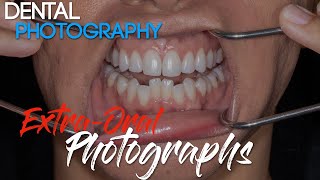 Dental Photography Basics  Dental Photography Techniques  Extraoral Photographs [upl. by Nalani213]