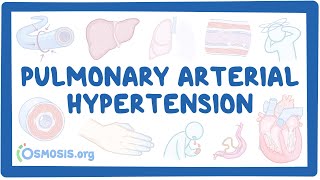 NORD  Pulmonary Arterial Hypertension [upl. by Adnauqaj]